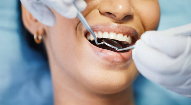 Best Emergency Dentist for Lost Fillings or Crowns in Carbondale, PA