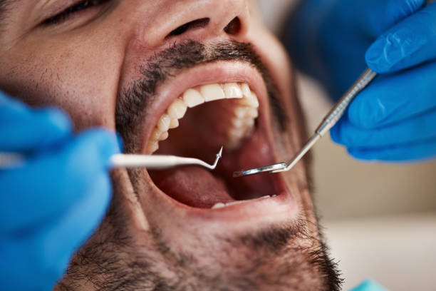 Best Emergency Root Canal Treatment in Carbondale, PA