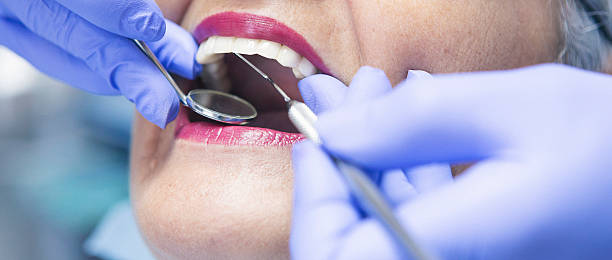 Best Emergency Dentist for Knocked-Out Tooth in Carbondale, PA